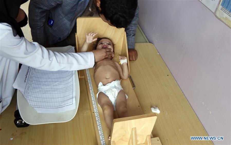 YEMEN-SANAA-CHILDREN-MALNUTRITION 